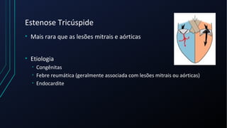 Estenose Tricúspide
• Mais rara que as lesões mitrais e aórticas
• Etiologia
• Congênitas
• Febre reumática (geralmente associada com lesões mitrais ou aórticas)
• Endocardite
 