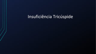 Insuficiência Tricúspide
 