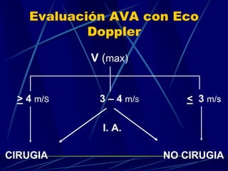 Evaluación AVA con Eco
Doppler
V (max)
> 4 m/S 3 – 4 m/S < 3 m/s
I. A.
CIRUGIA NO CIRUGIA
 