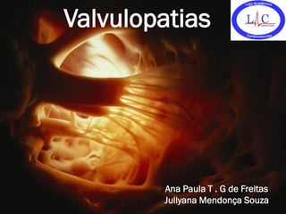 Valvulopatias
VA




             Ana Paula T . G de Freitas
             Jullyana Mendonça Souza
 