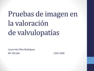Pruebas de imagen en
la valoración
de valvulopatías
Laura Inés Ríos Rodríguez
NP 101164                   2201 ODN
 