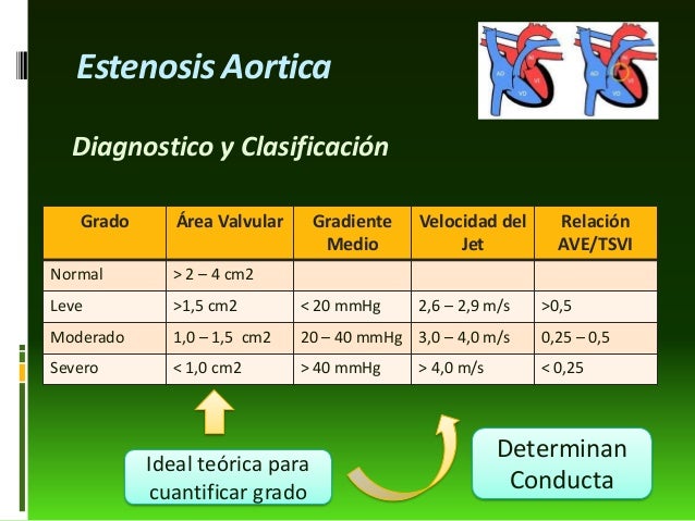 anestesia-en-valvulopat-as