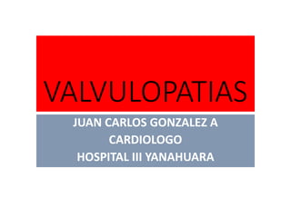 VALVULOPATIAS
JUAN CARLOS GONZALEZ A
CARDIOLOGO
HOSPITAL III YANAHUARA
 