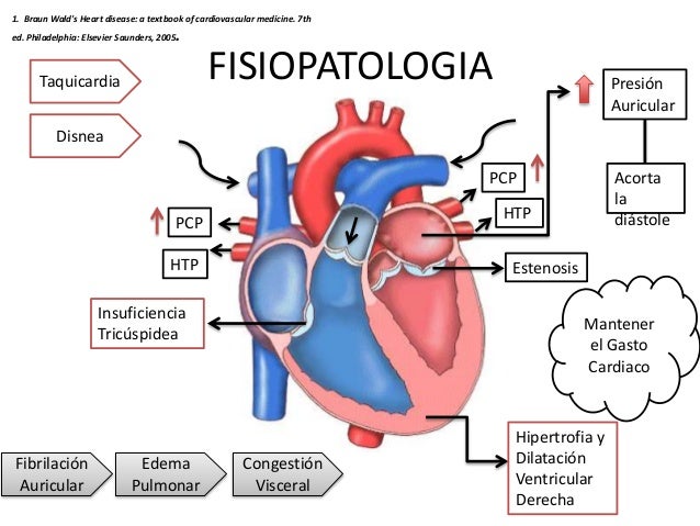 valvular disease