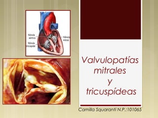 Valvulopatías
     mitrales
        y
  tricuspídeas
Camilla Squaranti N.P.:101065
 