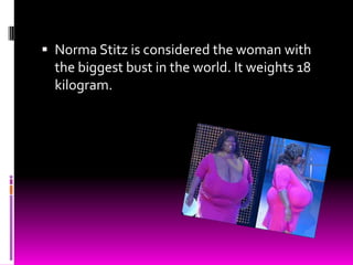  Norma Stitz is considered the woman with
  the biggest bust in the world. It weights 18
  kilogram.
 