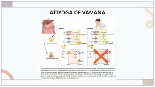 vamana poorva karma chart and mechanism of vamana NLH T dr Brp.pptx