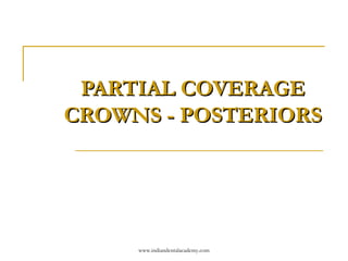 PARTIAL COVERAGE
CROWNS - POSTERIORS

www.indiandentalacademy.com

 