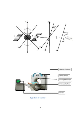 COMPUTED TOMOGRAPHY | DOCX