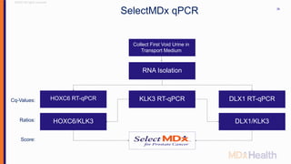 ©2017 All rights reserved
26
Collect First Void Urine in
Transport Medium
RNA Isolation
KLK3 RT-qPCRHOXC6 RT-qPCR
HOXC6/KLK3
DLX1 RT-qPCR
DLX1/KLK3
Cq-Values:
Ratios:
Score:
SelectMDx qPCR
 