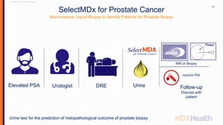 ©2017 All rights reserved
27
Elevated PSA Urologist DRE Urine
Urine test for the prediction of histopathological outcome of prostate biopsy
SelectMDx for Prostate Cancer
Non-invasive, Liquid Biopsy to Identify Patients for Prostate Biopsy
Follow-up
Discuss with
patient
MRi or Biopsy
routine PSA
 