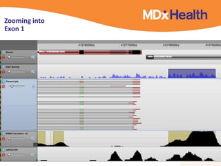 Zooming into
Exon 1
20
 