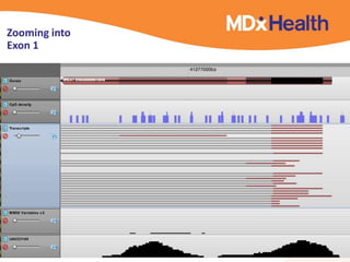 Zooming into
Exon 1
21
 