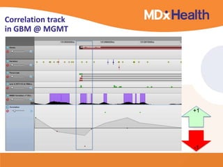 Correlation track
in GBM @ MGMT
+1
-1
 