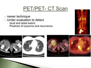    newer technique
   Under evaluation to detect
    ◦ local and distal extent,
    ◦ Predictor of outcome and recurrence
 