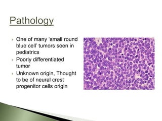    One of many ‘small round
    blue cell’ tumors seen in
    pediatrics
   Poorly differentiated
    tumor
   Unknown origin, Thought
    to be of neural crest
    progenitor cells origin
 