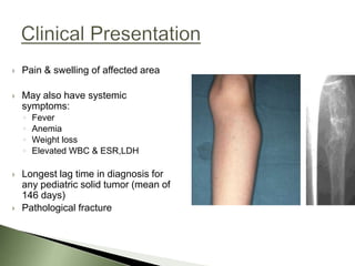   Pain & swelling of affected area

   May also have systemic
    symptoms:
    ◦   Fever
    ◦   Anemia
    ◦   Weight loss
    ◦   Elevated WBC & ESR,LDH

   Longest lag time in diagnosis for
    any pediatric solid tumor (mean of
    146 days)
   Pathological fracture
 