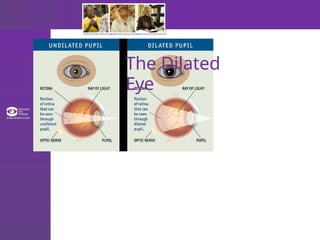 The Dilated
Eye
 