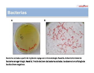 Vaneamiento arroz panama
