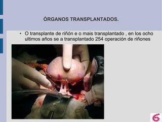ÓRGANOS TRANSPLANTADOS.
● O transplante de riñón e o mais transplantado , en los ocho
ultimos años se a transplantado 254 operación de riñones
 