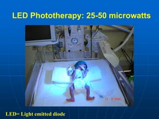 LED Phototherapy: 25-50 microwatts
LED= Light emitted diode
 