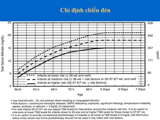 Chỉ định chiếu đèn
 