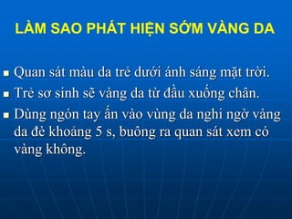 LÀM SAO PHÁT HIỆN SỚM VÀNG DA
 Quan sát màu da trẻ dưới ánh sáng mặt trời.
 Trẻ sơ sinh sẽ vàng da từ đầu xuống chân.
 Dùng ngón tay ấn vào vùng da nghi ngờ vàng
da đè khoảng 5 s, buông ra quan sát xem có
vàng không.
 