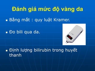 Đánh giá mức độ vàng da
 Bằng mắt : quy luật Kramer.
 Đo bili qua da.
 Định lượng bilirubin trong huyết
thanh
 