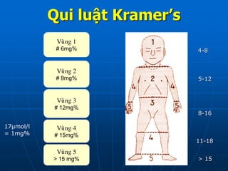 Qui luật Kramer’s
Vuøng 1
# 6mg%
Vuøng 2
# 9mg%
Vuøng 3
# 12mg%
Vuøng 4
# 15mg%
Vuøng 5
> 15 mg%
4-8
5-12
8-16
11-18
> 15
17µmol/l
= 1mg%
 
