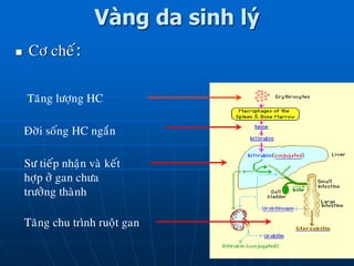 Vàng da sinh lý
 Cô cheá:
Taêng löôïng HC
Ñôøi soáng HC ngaén
Sö tieáp nhaän vaø keát
hôïp ôû gan chöa
tröôûng thaønh
Taêng chu trình ruoät gan
 