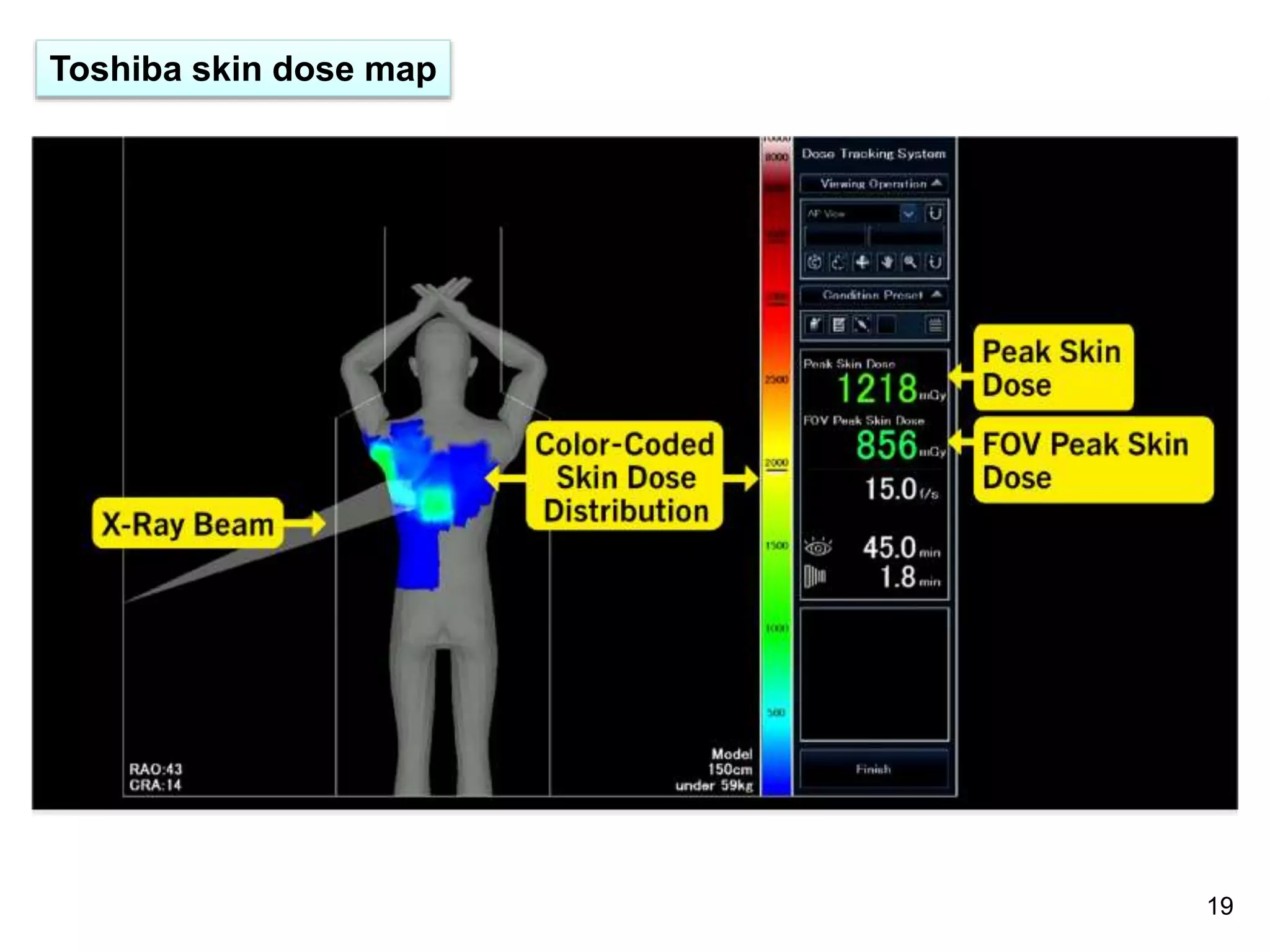 Toshiba skin dose map
19
 