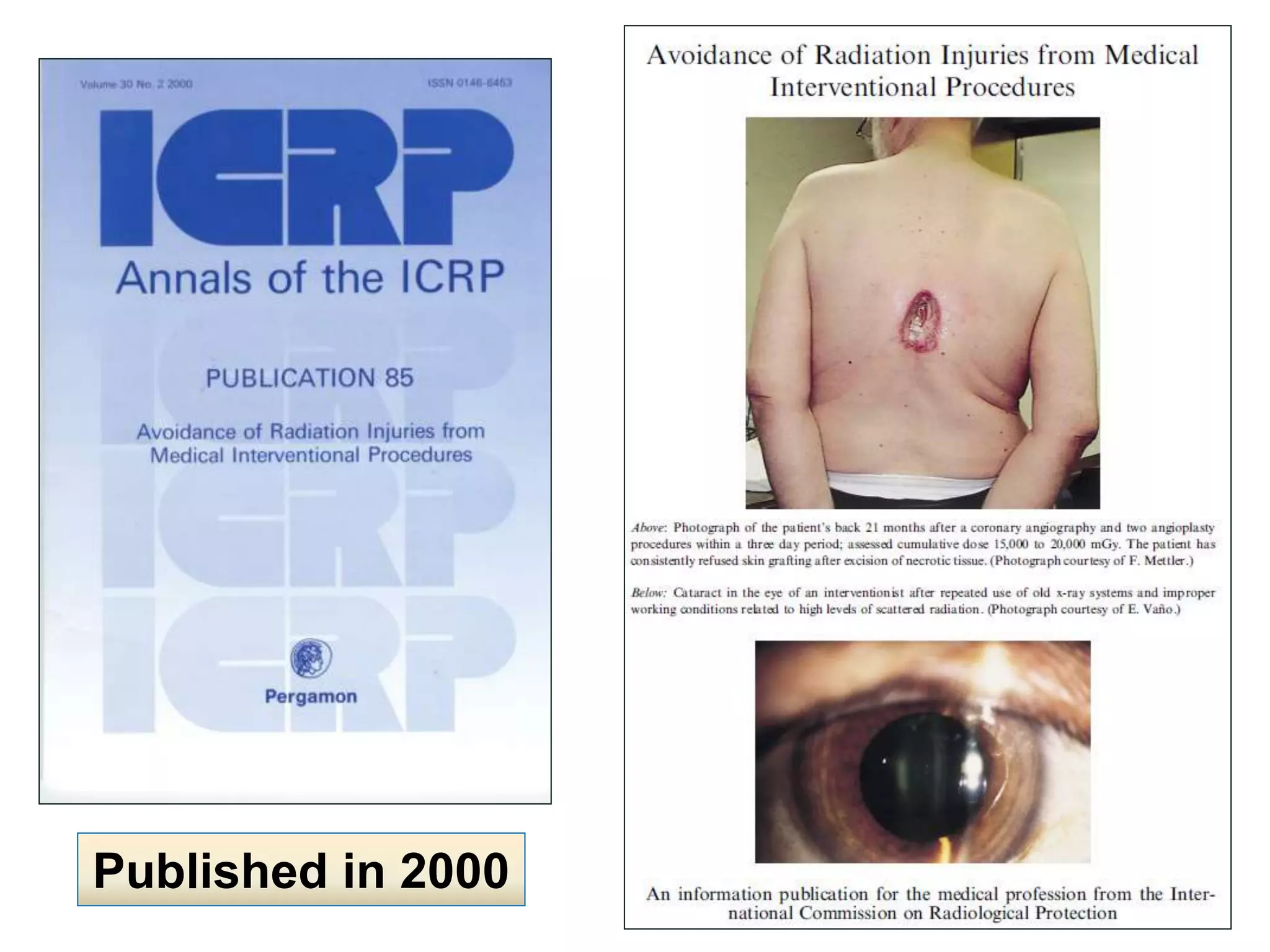 Published in 2000
29
 