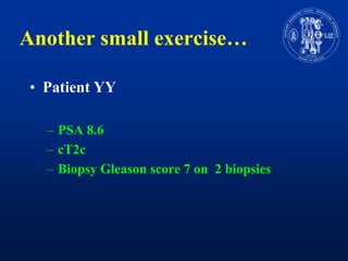 Anothersmallexercise…Patient YYPSA 8.6cT2cBiopsyGleason score 7 on 2 biopsies