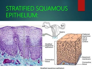 STRATIFIED SQUAMOUS
EPITHELIUM:
 