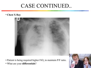 CASE CONTINUED..
• Chest X Ray
• Patient is being required higher FiO2 to maintain P/F ratio.
• What are your differentials?
 