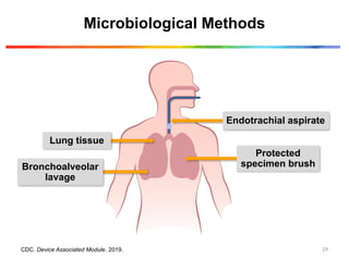Microbiological Methods
Bronchoalveolar
lavage
Protected
specimen brush
Endotrachial aspirate
Lung tissue
CDC. Device Associated Module. 2019. 29
 