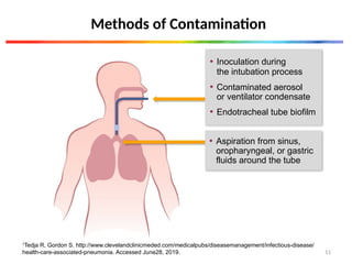 Methods of Contamination
1
Tedja R, Gordon S. http://www.clevelandclinicmeded.com/medicalpubs/diseasemanagement/infectious-disease/
health-care-associated-pneumonia. Accessed June28, 2019.
• Inoculation during
the intubation process
• Contaminated aerosol
or ventilator condensate
• Endotracheal tube biofilm
• Aspiration from sinus,
oropharyngeal, or gastric
fluids around the tube
11
 
