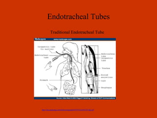 Endotracheal Tubes Traditional Endotracheal Tube 