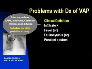elfbar elfa master akku Strategies in the prevention of ventilator-associated pneumonia main image 1