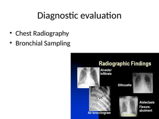 vap a.pptx explained Ventilator associated pneumonia | PPTX