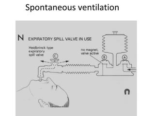 Spontaneous ventilation
 