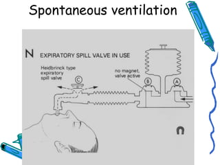 Spontaneous ventilation
 