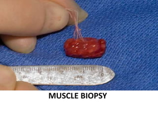 MUSCLE BIOPSY
 