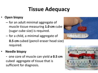 Tissue Adequacy
• Open biopsy
– for an adult minimal aggregate of
muscle tissue measuring 1.0 cm cube
(sugar cube size) is required.
– for a child, a minimal aggregate of
0.5 cm cubed (pencil eraser head size)
required.
• Needle biopsy
- one core of muscle can yield a 0.5 cm
cubed aggregate of tissue that is
sufficient for diagnosis.
 
