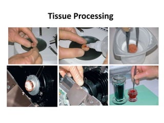 Tissue Processing
 