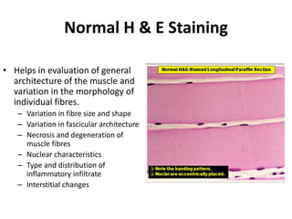 Normal H & E Staining
• Helps in evaluation of general
architecture of the muscle and
variation in the morphology of
individual fibres.
– Variation in fibre size and shape
– Variation in fascicular architecture
– Necrosis and degeneration of
muscle fibres
– Nuclear characteristics
– Type and distribution of
inflammatory infiltrate
– Interstitial changes
 