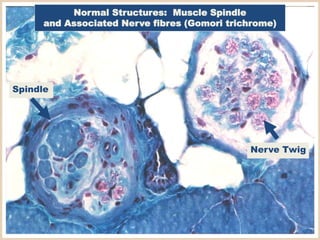 Spindle
Nerve Twig
Normal Structures: Muscle Spindle
and Associated Nerve fibres (Gomori trichrome)
 
