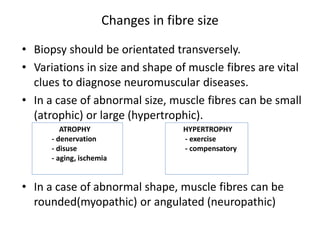 • Biopsy should be orientated transversely.
• Variations in size and shape of muscle fibres are vital
clues to diagnose neuromuscular diseases.
• In a case of abnormal size, muscle fibres can be small
(atrophic) or large (hypertrophic).
• In a case of abnormal shape, muscle fibres can be
rounded(myopathic) or angulated (neuropathic)
Changes in fibre size
ATROPHY
- denervation
- disuse
- aging, ischemia
HYPERTROPHY
- exercise
- compensatory
 