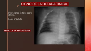 variantes-anatomicas-del-torax-pptx