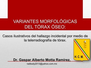 Dr. Gaspar Alberto Motta Ramírez,
radbody2013@yahoo.com.mx
VARIANTES MORFOLÓGICAS
DEL TÓRAX ÓSEO:
Casos ilustrativos del hallazgo incidental por medio de
la telerradiografía de tórax.
 